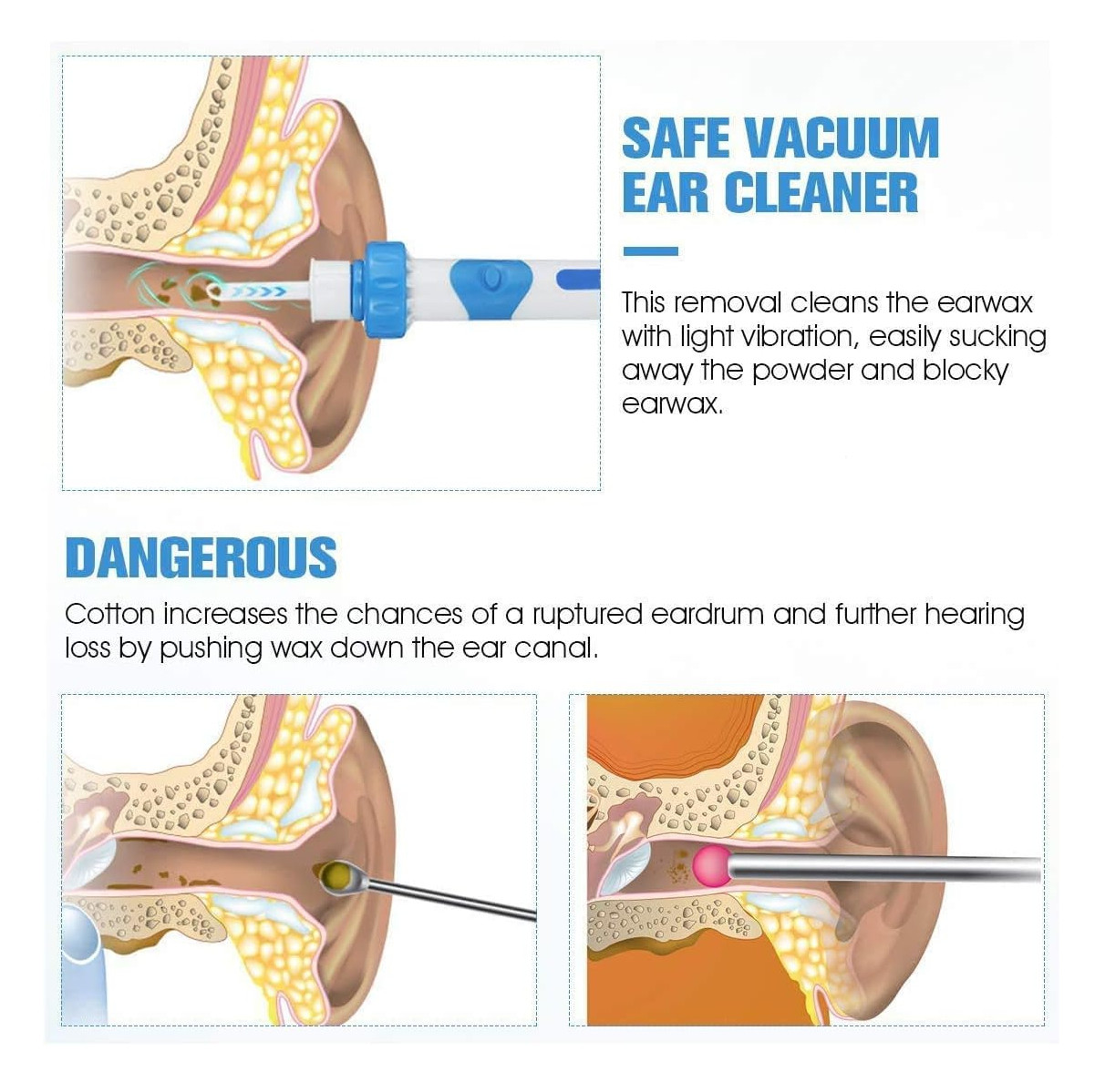 Miniatura 2 de Limpiador De Oidos Electrico Remove cera